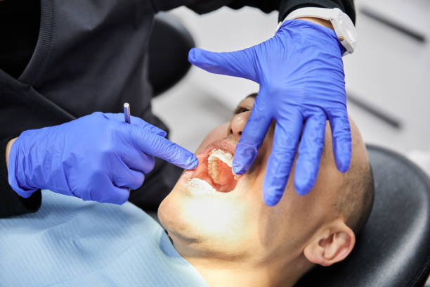 Best Emergency Broken Tooth Repair in Madisonville, TN